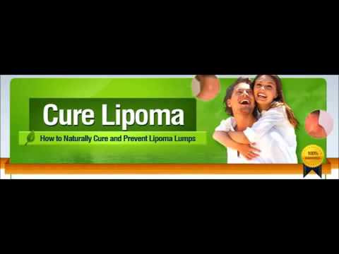 how to cure lipoma