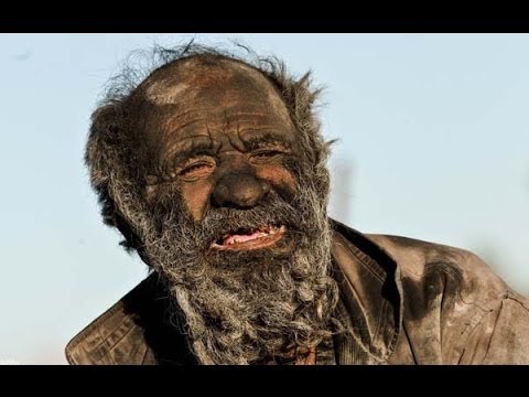 Un hombre lleva 60 años sin bañarse