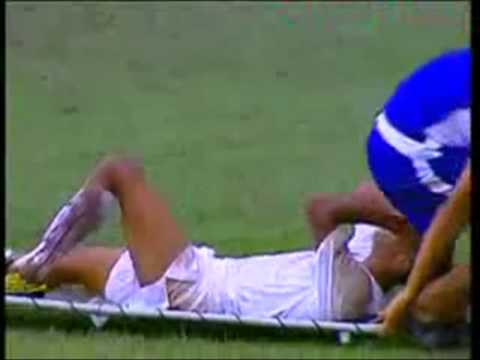 0 El camillero mas tonto del futbol
