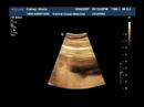 baby-cathey-12-weeks-part-4.html