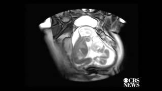 in utero, le bébé boit...pas mal de liquide amniotique!
