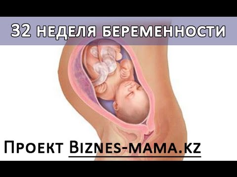 Кто родился на 32 неделе беременности