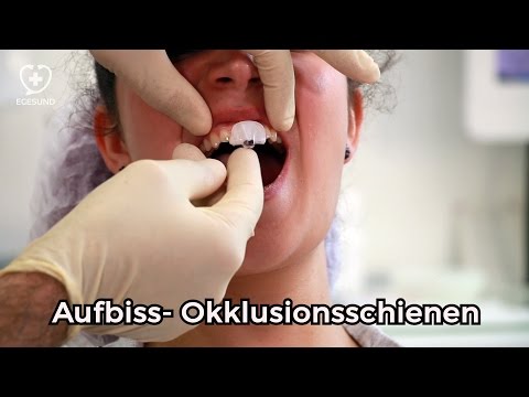 Aufbissschiene (Knirscherschiene)