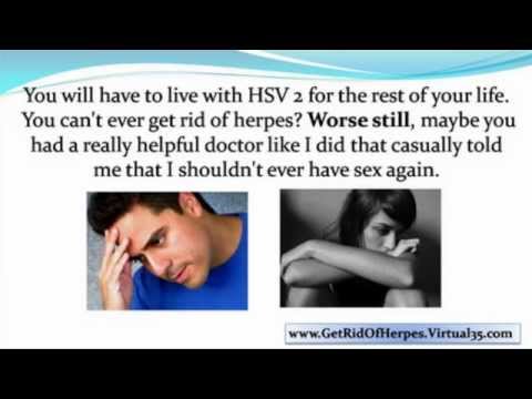 how to treat oral herpes