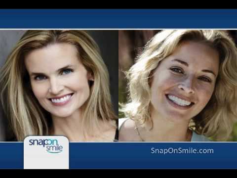 how to get snap on smile