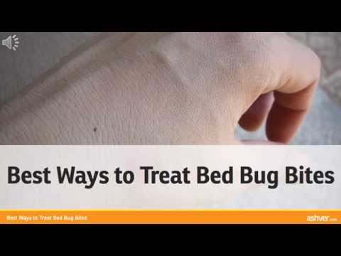 how to relieve bed bug itch