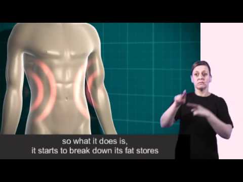 diabetes uk - Diabetes UK has worked with RNID to produce information in British Sign Language (BSL) for the people with diabetes in the Deaf community.