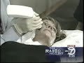 A Thermage Facelift. No Surgery--Just Results!