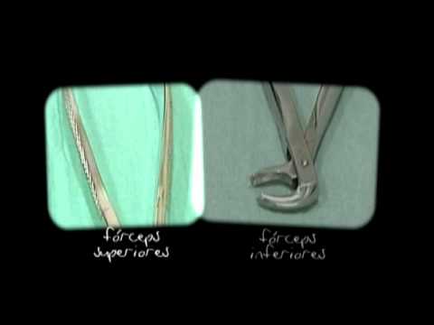 cirugía dental - La exodoncia es la parte de la cirugía bucal encargada de la extracción de un diente del lecho óseo donde esta ubicado. Para lograr este fin con éxito se req...