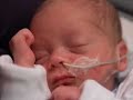 Preemie Twins: Birth to 3 Months Preemie Twins: Birth to 3 Months