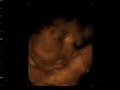 lawrence marteen malabanan 4d lawrence marteen malabanan 4d