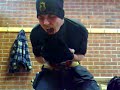 Click here to watch this video electrical nerve stimulation 2