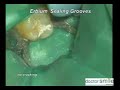 Erbium laser clinical treatment
