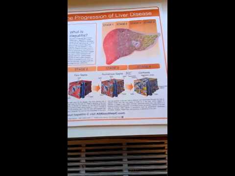 how to read hepatitis c test results