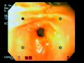 Endoscopia Endoscopia