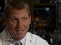 Resveratrol Hair Loss Treatment and Baldness Cure