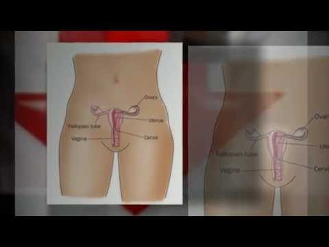 how to treat ovarian cysts