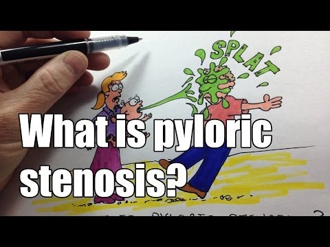 how to repair pyloric valve