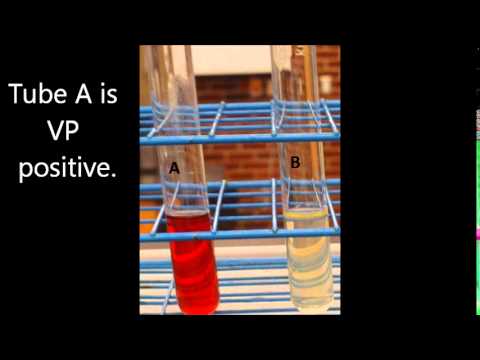 how to do mr vp test