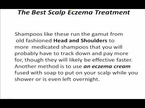 how to treat eczema on scalp