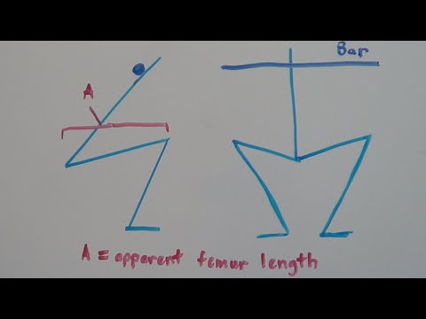 how to measure femur length