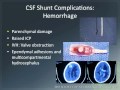 Emergency Evaluation of Hydrocephalus and Shunts