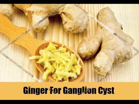 how to treat ganglion cyst