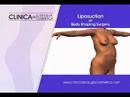 cosmetic surgery ( cirugia cosmetica )