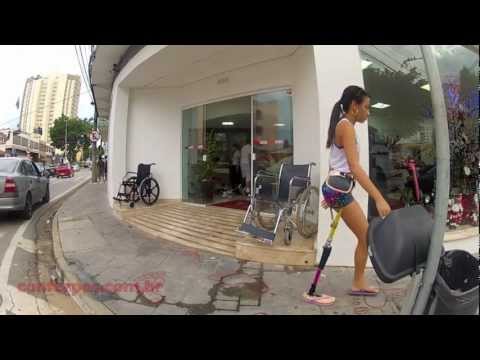 Prótese Desarticulação de Quadril - Taiana - Ortopedia Conforpés
