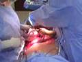 Awesome c-section. Miracle baby!