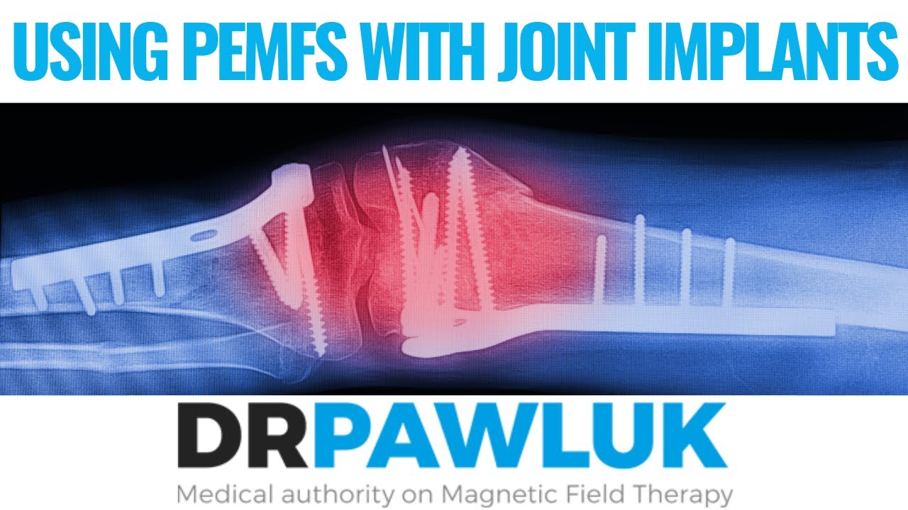 Can Magnetic Field Therapy be used if you have Joint Implants?