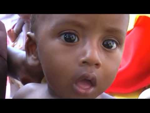 how to cure malnutrition