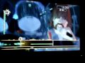 Creep 100% FC X VOX 179K.MPG