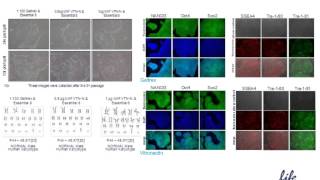 Considerations for the culture of pluripotent stem