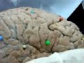 aula de neurologia para prova praatica (faculdade integrada do ceará)FIC