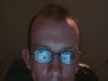 tinnitus fixed with scenar update 2