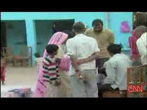 0 photo 0 2 Faced Baby Born in India picture