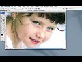 Photoshop Blemish removal Photoshop Blemish removal