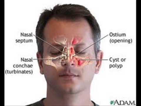how to control lungs infection
