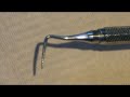 Crown Lengthening Part 2