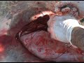 Cesarea Cesarea