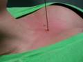 Kimbers Surface Piercing