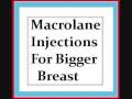 Macrolane Injections  Breast Enlargement  Before and After Photos