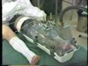 Treatment of peripheral vascular diseases II Treatment of peripheral vascular diseases II