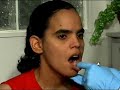 Oral Health Exam Oral Health Exam