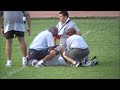 Broken Fibula
