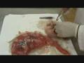 videos de aperturauterogestante.wmv