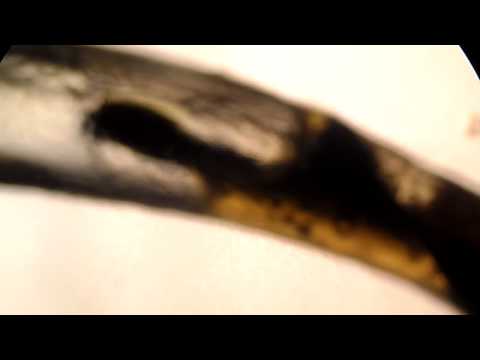 how to dissolve tissue