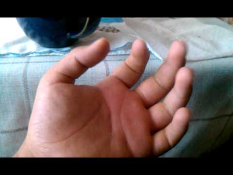 how to relieve swelling from a bee sting