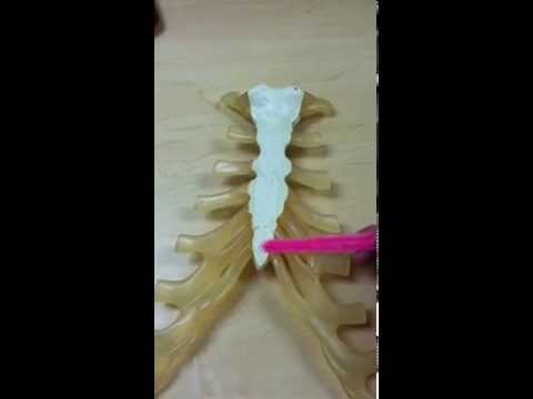 how to treat a broken xiphoid process